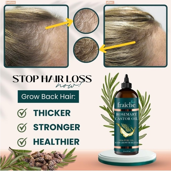 Castor Oil with Rosemary Oil for Hair Reduce Hair Loss & Promote a Healthy Scalp - Picture 2 of 7